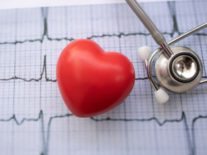 UNDERSTANDING WHAT A HEART ARRHYTHMIA IS ALL ABOUT