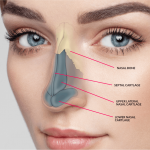 The Steps To Be Followed After Nose Surgery